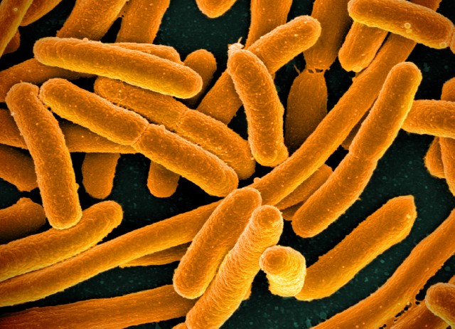 e_coli