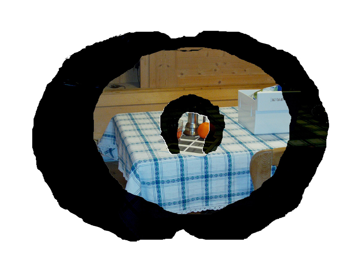 vision_glaucoma